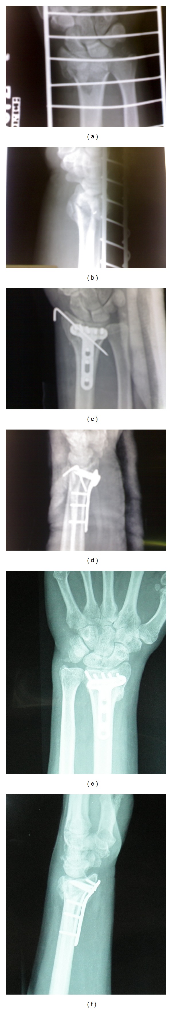 Figure 2