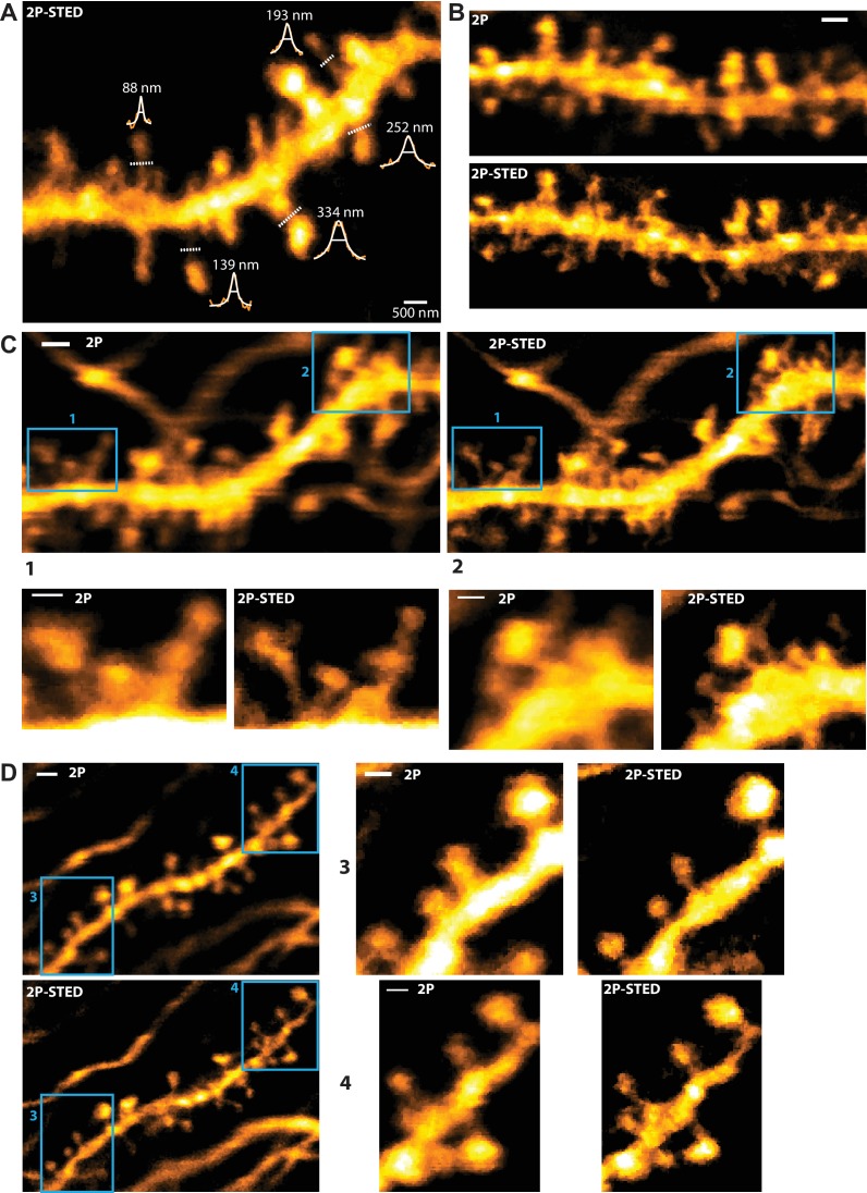 Figure 1—figure supplement 2.