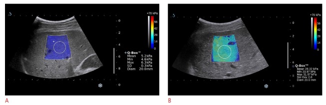 Fig 5.