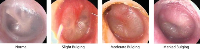 FIG 3