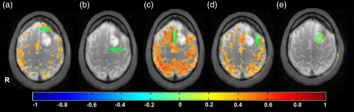 Figure 5