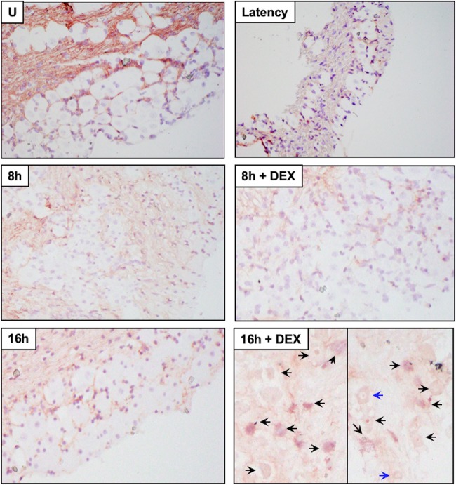 FIG 6