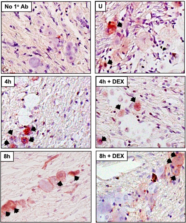 FIG 3