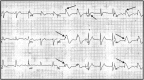 Fig 5.