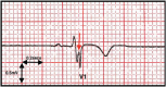 Fig 4.