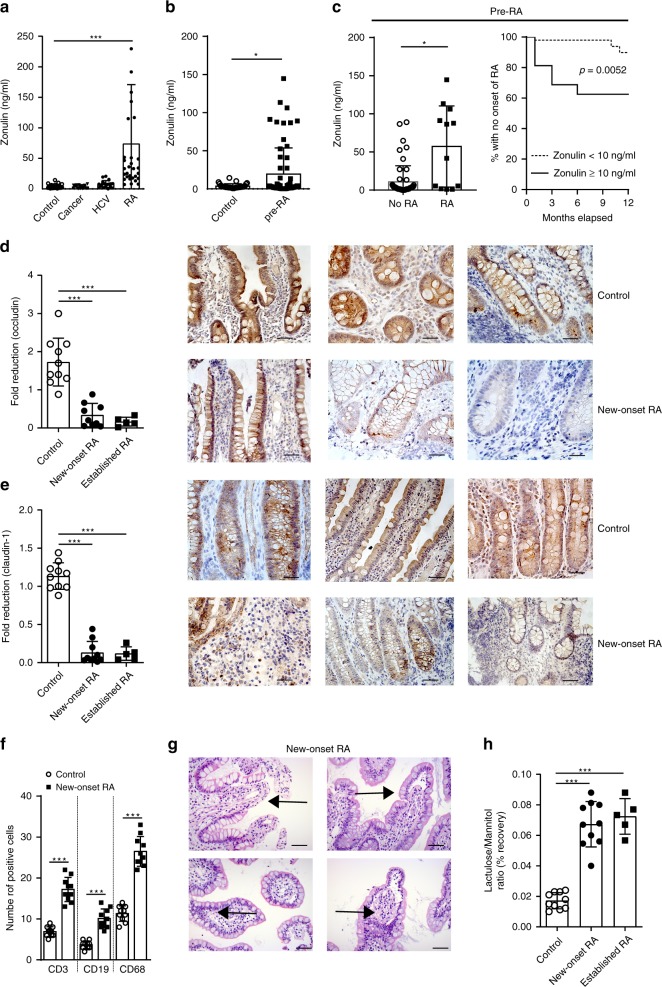 Targeting zonulin and intestinal epithelial barrier function to prevent ...