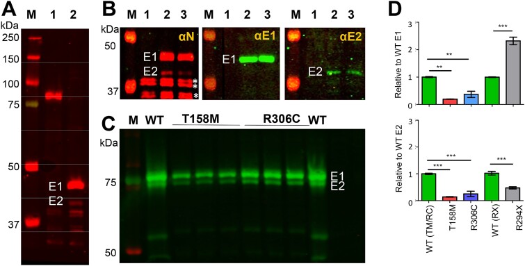 Comparing the MeCP2 constructs E1 and E2 isoforms using western blots.