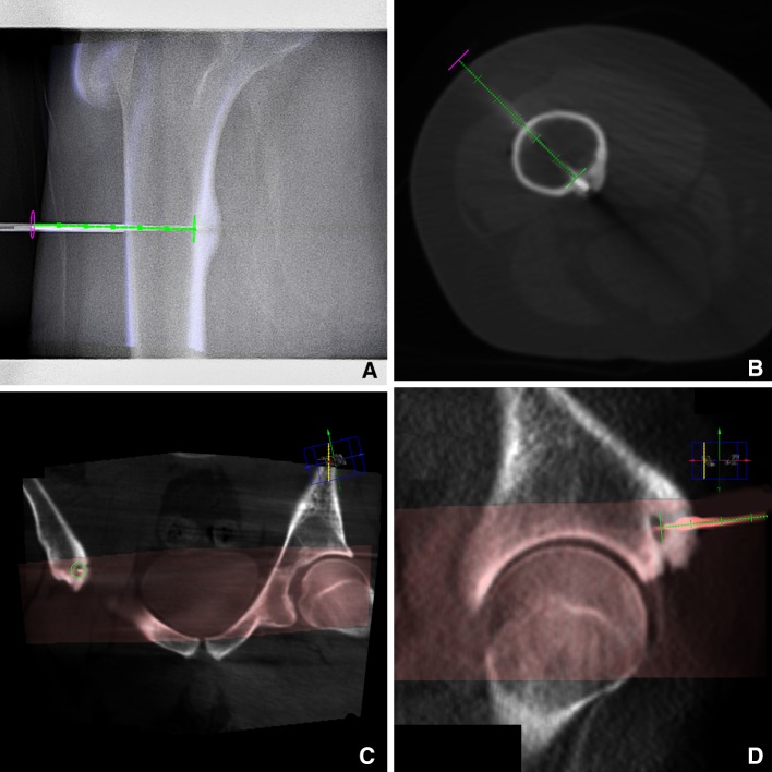 Fig. 1