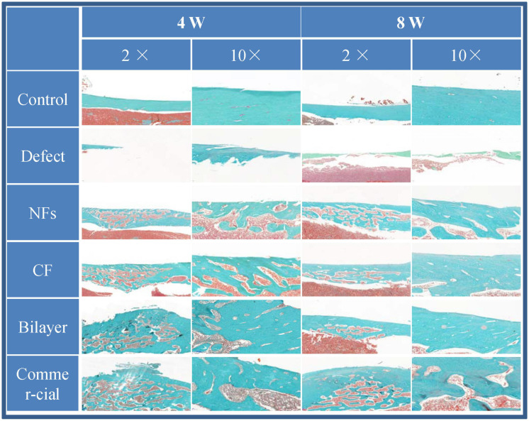 FIGURE 11