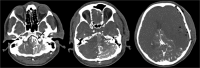 Fig. – 1