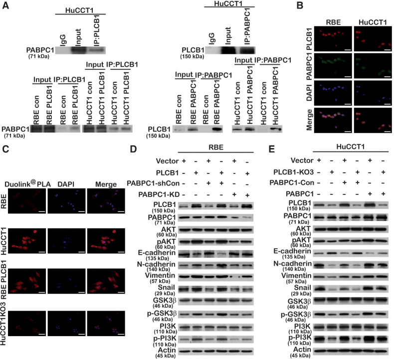 Figure 6. PABPC1 is closely related to PLCB1-mediated PI3K/AKT/GSK3β/snail signaling in CCA. A, Endogenous and exogenous coimmunoprecipitation indicated that PLCB1 could interact with PABPC1. B, Colocalization between PLCB1 and PABPC1 was explored by immunofluorescence in the indicated CCA cell lines. Scale bars, 400× = 100 μm. C, Typical images of the Duolink PLA experiment predicted PABPC1 directly interacted with PLCB1 via the fluorescence microscope. Scale bars, 400× = 100 μm. D and E, The expression levels of key proteins of the PI3K/AKT pathway and EMT process for indicated CCA cell lines were determined by Western blot after stable PABPC1 knockdown and overexpression lentiviral transfection. All experiments were implemented three times, and data are presented as mean ± SD.