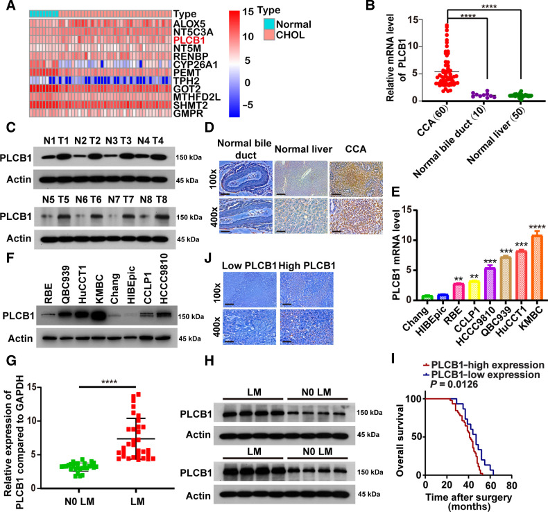 Figure 1. Overexpression of PLCB1 in human CCA. A, Heat map presented candidate metabolic genes from The Cancer Genome Atlas and Kyoto Encyclopedia of Genes and Genomes databases and these genes had statistical significance in differential expression and survival prognosis. CHOL, CCA tissues. B, PLCB1 mRNA levels were increased in 60 human CCA tissues compared with 50 corresponding normal liver samples and 10 normal bile duct samples. ****, P < 0.0001, based on Student t test. C, Typical images of PLCB1 protein levels in 60 paired human CCA and adjacent tissues. T, tumors; N, adjacent normal tissues. D, Typical images of PLCB1 IHC staining in CCA, normal liver tissues, and normal bile duct tissues. Scale bars, 100× = 400 μm; 400× = 100 μm. E, PLCB1 mRNA levels in CCA cells compared with normal liver (Chang) and normal human intrahepatic biliary (HIBEpiC) cell lines were evaluated by qRT-PCR. **, P < 0.01; ***, P < 0.001; ****, P < 0.0001, based on the one-way ANOVA. F, Western blot indicated PLCB1 protein levels in CCA cells were higher than normal liver (Chang) and normal human intrahepatic biliary (HIBEpiC) cell lines. G, CCA patients with lymph node metastasis presented higher PLCB1 mRNA levels. ****, P < 0.0001, based on Student t test. H, Typical images of PLCB1 protein levels in CCA patients with or without lymph node metastasis. LM, lymph node metastasis; N0 LM, no lymph node metastasis. I, The influence of PLCB1 strong or weak staining on OS was analyzed by Kaplan–Meier plot. OS, overall survival. J, Typical IHC images of the relationship between expression of PLCB1 and Ki-67 in clinical CCA samples. Scale bars, 100× = 400 μm; 400× = 100 μm. All experiments were implemented three times and data are presented as mean ± SD.