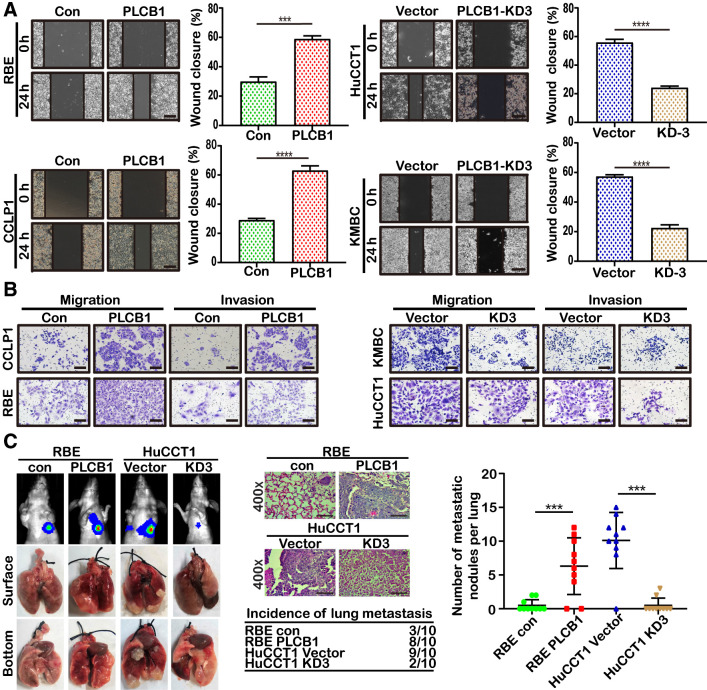 Figure 3. PLCB1 is important for the migration and invasion of CCA cells. A, Wound-healing assays for indicated cell lines showed motility changes with PLCB1 expression. ***, P < 0.001; ****, P < 0.0001, based on Student t test. Scale bars, 100× = 400 μm. B, Typical images of Matrigel-coated (for invasion) and Matrigel-uncoated (for migration) transwell assays for indicated cell lines. Scale bars, 100× = 400 μm. C, Typical images of bioluminescence pictures, specimens, and hematoxylin and eosin staining of lung metastasis for indicated CCA cell lines. ***, P < 0.001, based on Student t test. Scale bars, 400× = 100 μm. All experiments were implemented three times, and data are presented as mean ± SD.