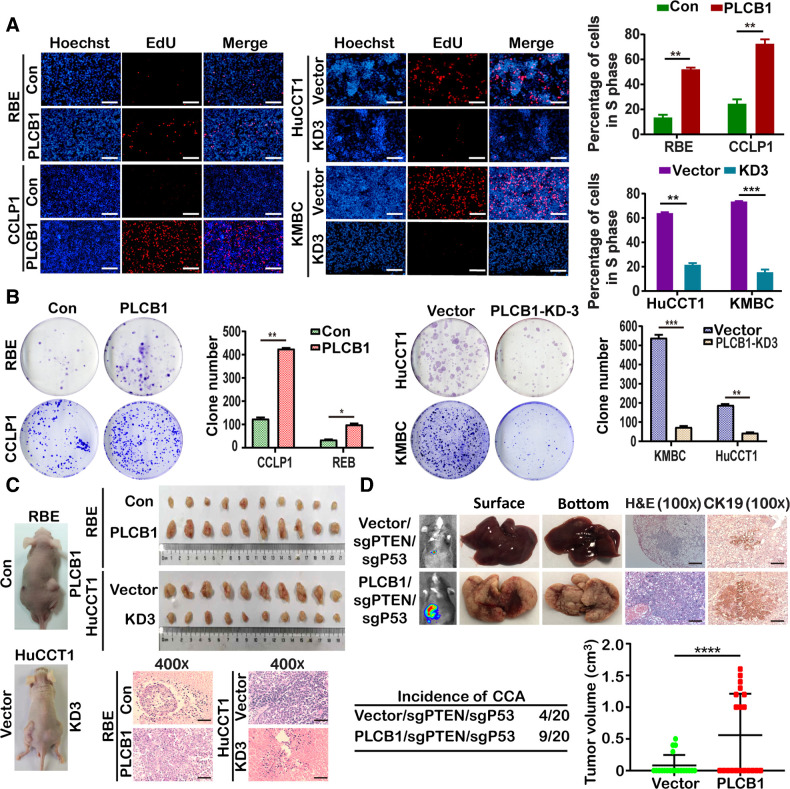 Figure 2. PLCB1 is important for the proliferation and oncogenicity of CCA cells. A, PLCB1 overexpression and knockdown could affect proliferation abilities of indicated CCA cell lines via Edu assay analysis. **, P < 0.01; ***, P < 0.001, based on Student t test. Scale bars, 100× = 400 μm. B, Typical images of colony formation assays and colony counts. *, P < 0.1; **, P < 0.01; ***, P < 0.001, based on Student t test. C, Typical images of subcutaneous xenograft mice models and hematoxylin and eosin staining. Scale bars, 400× = 100 μm. D, Typical images of bioluminescence pictures, hematoxylin and eosin (H&E), and CK19 staining of vector/sgPTEN/sgP53 and PLCB1/sgPTEN/sgP53 C57BL mice livers at 8 weeks after hydrodynamic injection respectively. ****, P < 0.0001, based on Student t test. Scale bars, 100× = 400 μm. All experiments were implemented three times, and data are presented as mean ± SD.