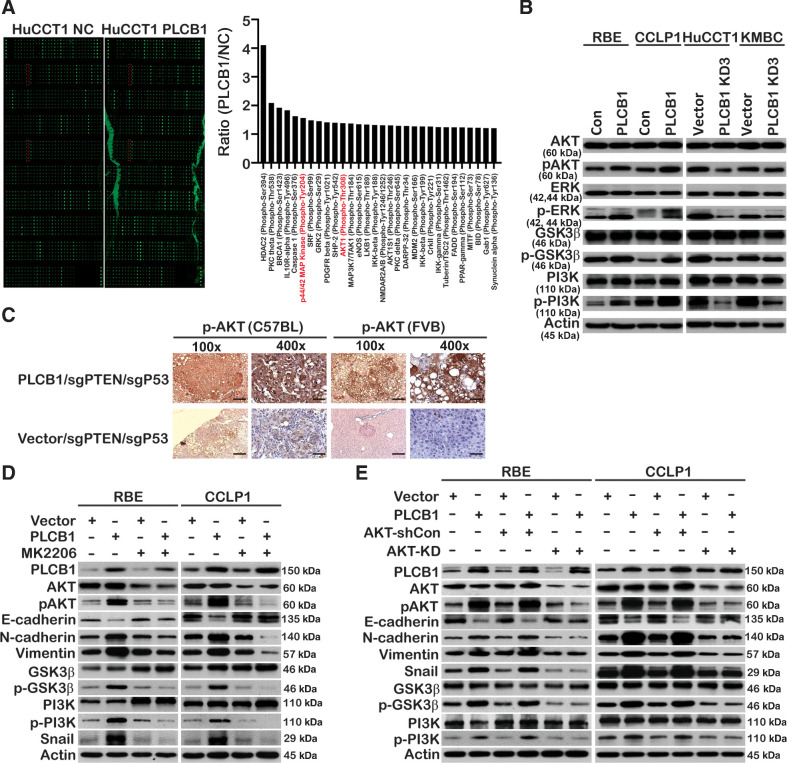 Figure 5. The PI3K/AKT/GSK3β/snail axis is vital for PLCB1-mediated EMT. A, Phosphoproteome array analysis of the expression changes of 157 phospho-specific proteins and 147 non-phospho pairs of 16 cell signaling pathways upon PLCB1 overexpression in HuCCT1 cells. Phosphorylation levels increased by FC (fold changes) ≥ 1.2 compared between HuCCT1 PLCB1 cell lines and HuCCT1 cell lines are shown in the histogram. The phosphorylated proteins of the PI3K/AKT and ERK pathways, which we paid more attention, are labeled red. B, Western blot analysis of key proteins in the PI3K/AKT and ERK pathways for indicated cell lines. C, Typical images of IHC staining in C57BL and FVB/N (H2d) mice spontaneous tumor tissues presented PLCB1 overexpression enhanced the expression level of pAKT. Scale bars, 100× = 400 μm; 400× = 100 μm. D, The expression levels of key proteins of the PI3K/AKT pathway and EMT process for indicated CCA cell lines were determined by Western blot after the treatment of 0.2 μmol/L MK2206. E, The expression levels of key proteins of the PI3K/AKT pathway and EMT process in the indicated cell lines were determined by Western blot after stably transfected AKT knockdown lentivirus. All experiments were implemented three times, and data are presented as mean ± SD.