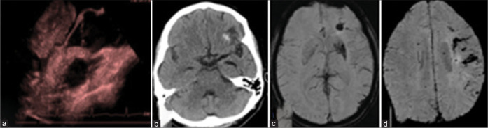 Figure 12: