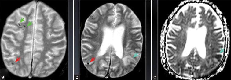 Figure 11: