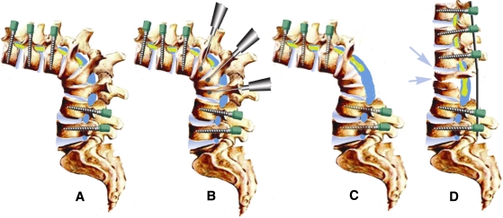 Fig. 2