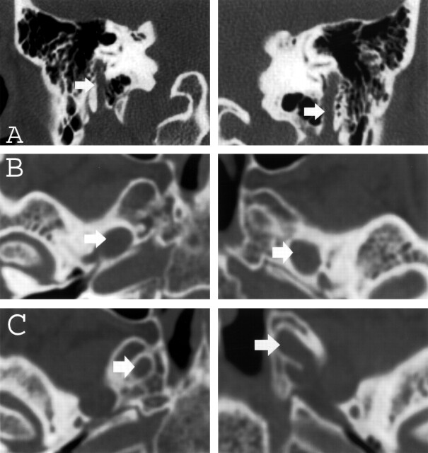 Fig 2.