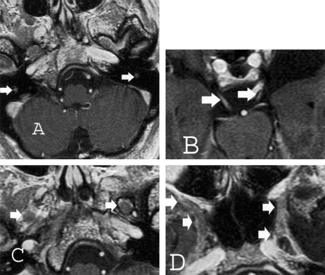 Fig 3.