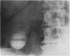 381