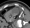 Figure 4b: