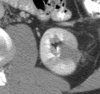 Figure 5d: