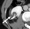 Figure 3b: