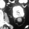 Figure 1b: