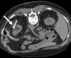 Figure 2b: