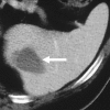 Figure 6b: