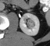 Figure 5a: