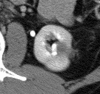 Figure 5e: