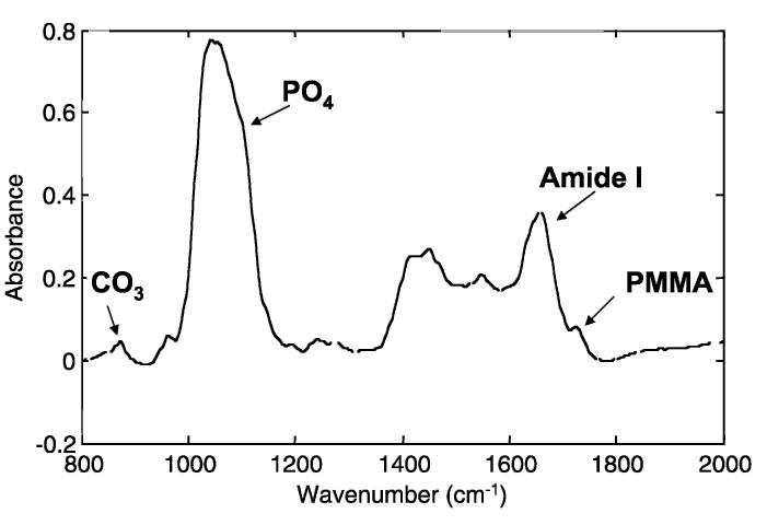 Fig 1.