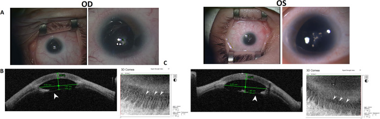 Fig. 2