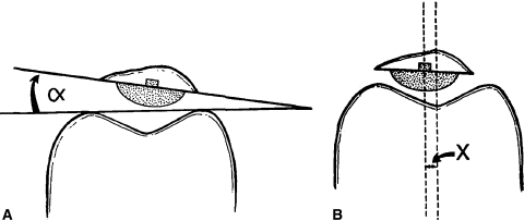 Fig. 1A–B