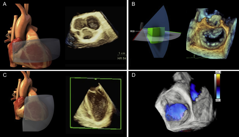 Fig 3