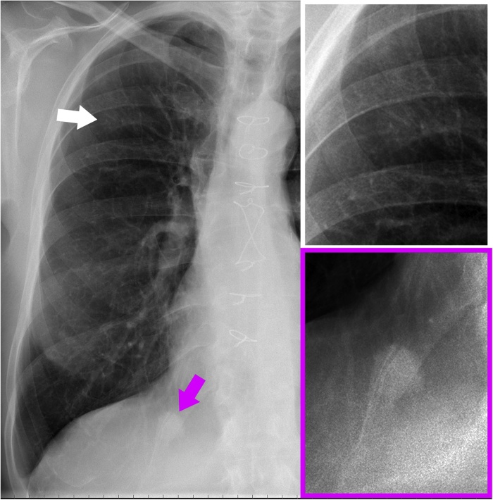 Fig. 1