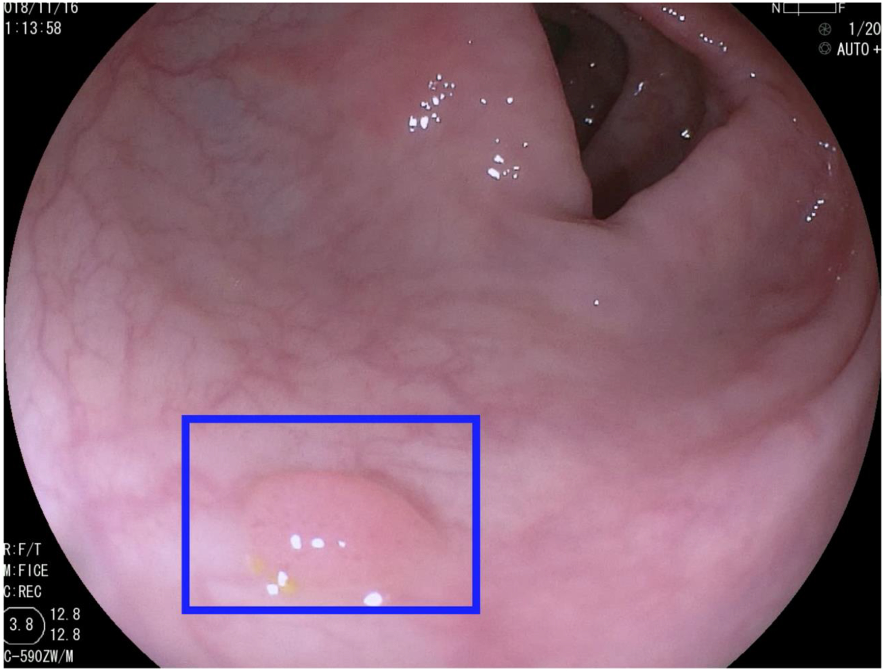 Fig. 2