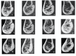 Fig.1