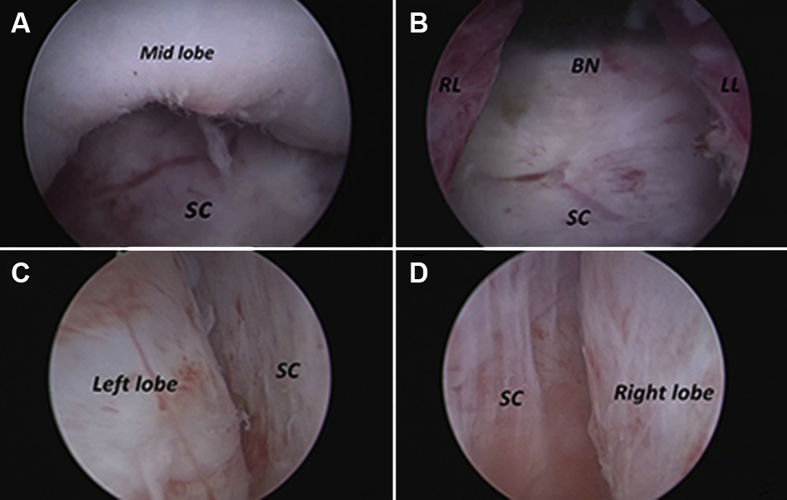 Figure 4