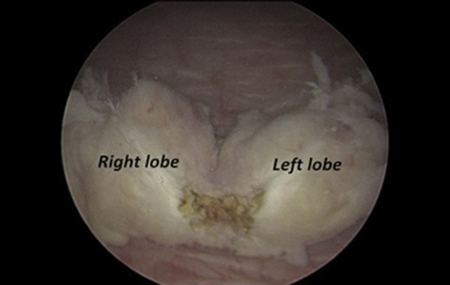 Figure 2