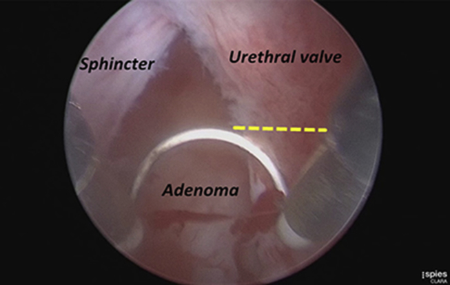 Figure 3