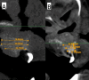 Fig. 9