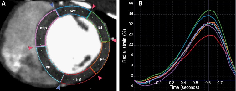 Figure 1: