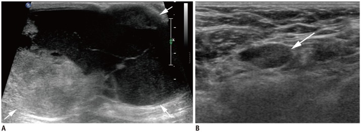 Fig. 15