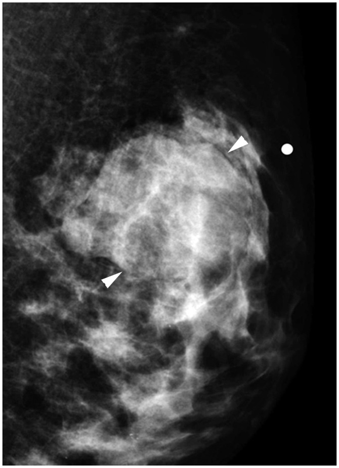 Fig. 16