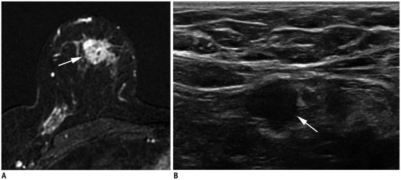 Fig. 12