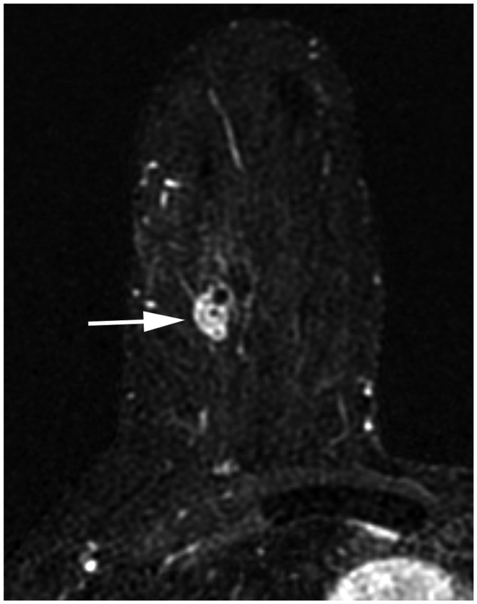 Fig. 13