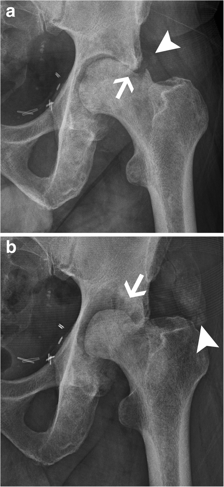 Fig. 13